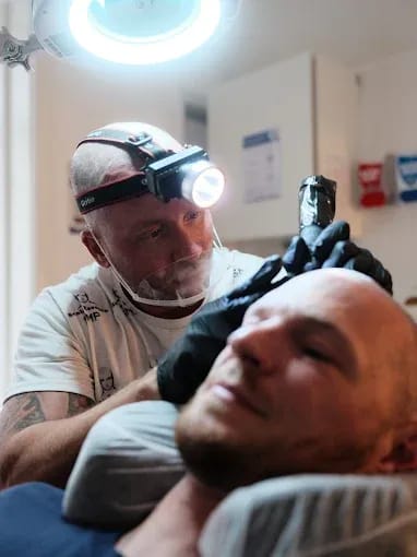SMP Hair Treatment London | Non-Surgical Hair Restoration